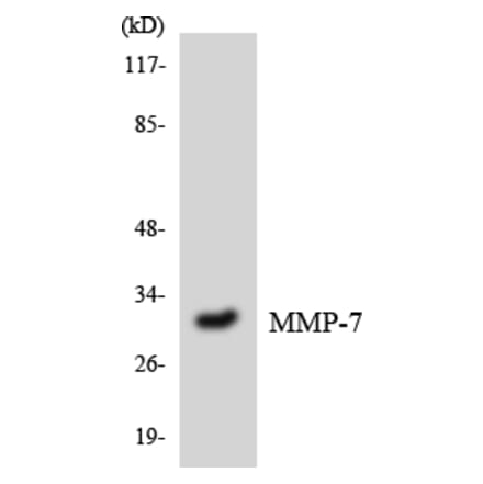 Western Blot - Anti-MMP-7 Antibody (R12-3022) - Antibodies.com
