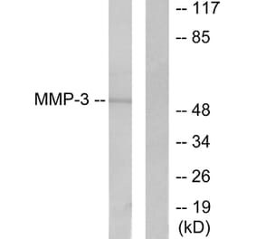 Western Blot - Anti-MMP-3 Antibody (C0272) - Antibodies.com