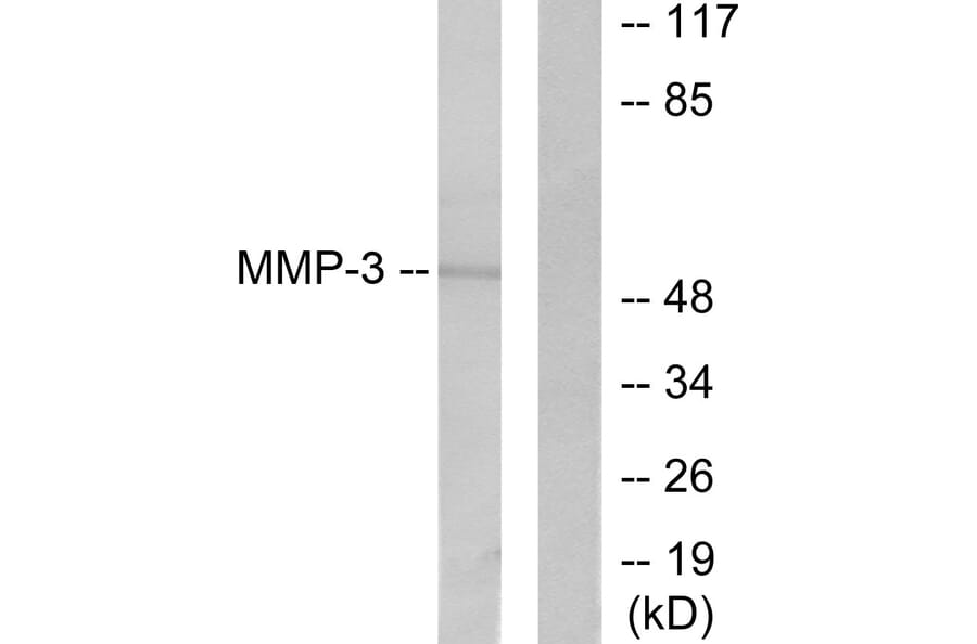 Western Blot - Anti-MMP-3 Antibody (C0272) - Antibodies.com