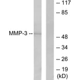 Western Blot - Anti-MMP-3 Antibody (C0272) - Antibodies.com
