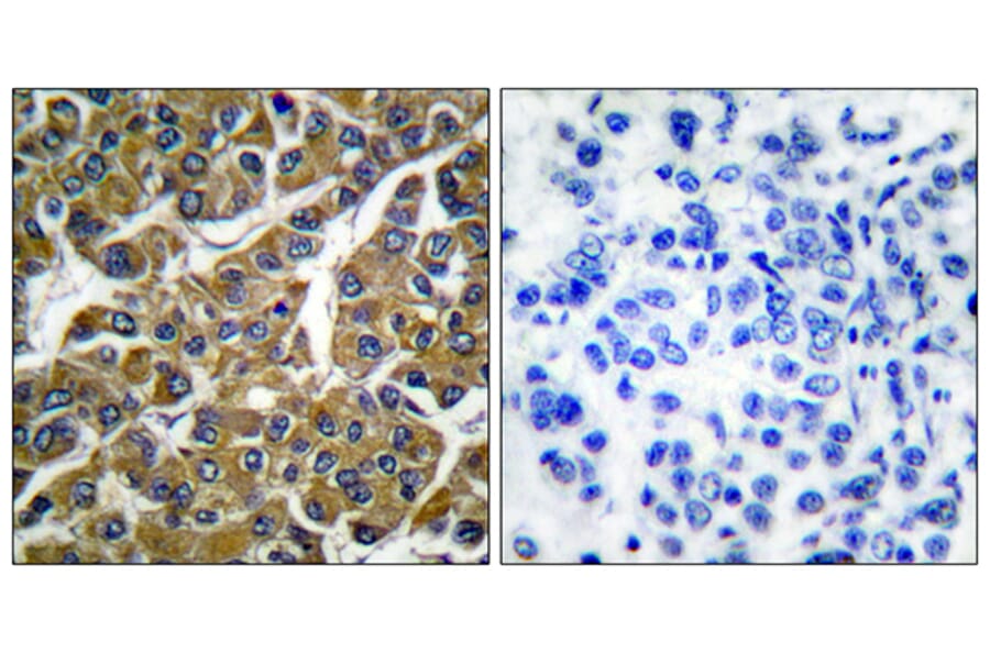 Immunohistochemistry - Anti-MMP-3 Antibody (C0272) - Antibodies.com