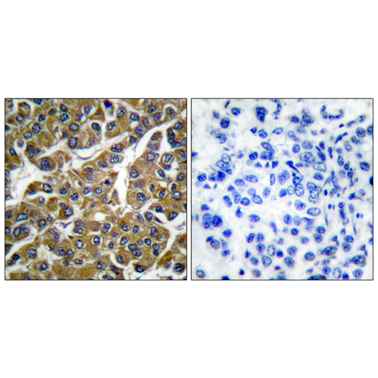 Immunohistochemistry - Anti-MMP-3 Antibody (C0272) - Antibodies.com