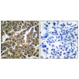 Immunohistochemistry - Anti-MMP-3 Antibody (C0272) - Antibodies.com