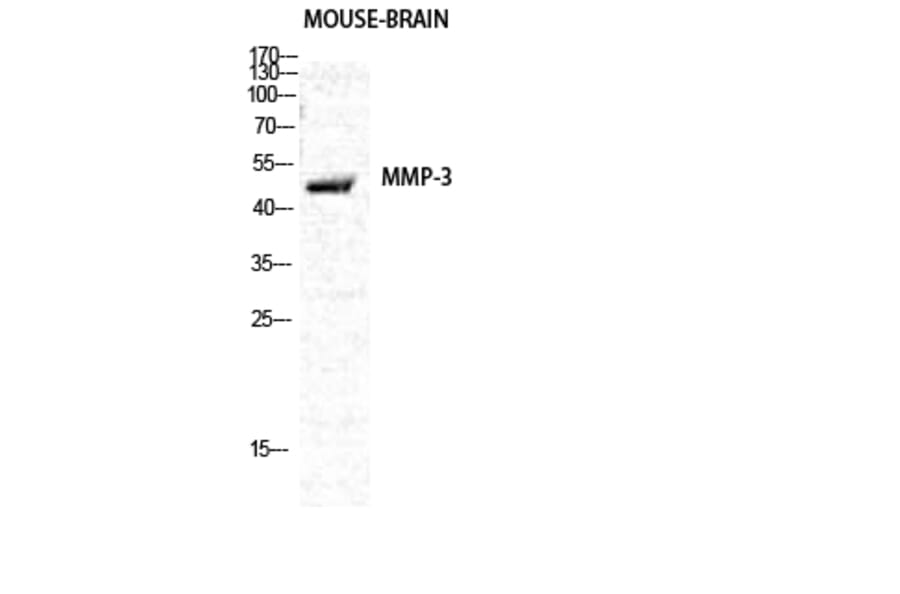 Western Blot - Anti-MMP-3 Antibody (C0272) - Antibodies.com
