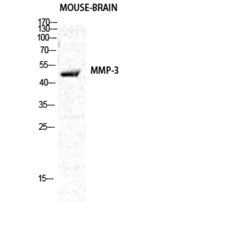 Western Blot - Anti-MMP-3 Antibody (C0272) - Antibodies.com