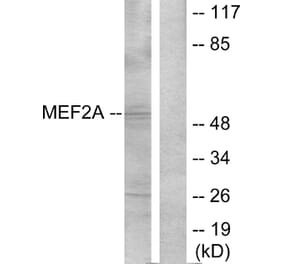 Western Blot - Anti-MEF2A Antibody (B7144) - Antibodies.com