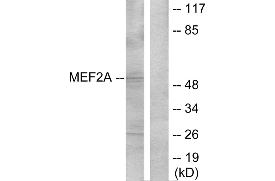 Western Blot - Anti-MEF2A Antibody (B7144) - Antibodies.com