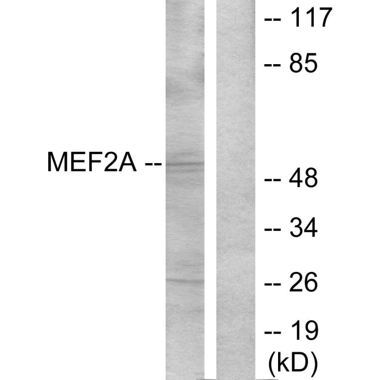 Western Blot - Anti-MEF2A Antibody (B7144) - Antibodies.com