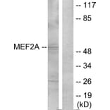 Western Blot - Anti-MEF2A Antibody (B7144) - Antibodies.com