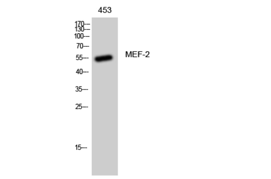 Western Blot - Anti-MEF2A Antibody (B7144) - Antibodies.com