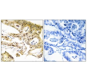 Immunohistochemistry - Anti-MED23 Antibody (C11881) - Antibodies.com