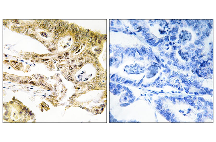 Immunohistochemistry - Anti-MED23 Antibody (C11881) - Antibodies.com