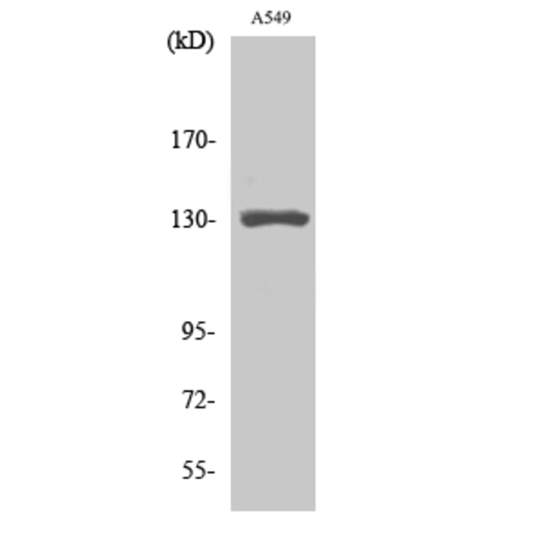 Western Blot - Anti-MED23 Antibody (C11881) - Antibodies.com