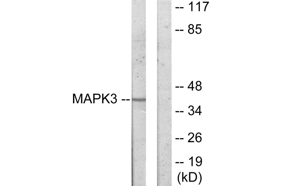 Western Blot - Anti-MAPK3 Antibody (C11133) - Antibodies.com