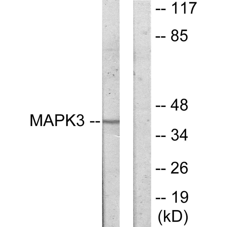 Western Blot - Anti-MAPK3 Antibody (C11133) - Antibodies.com