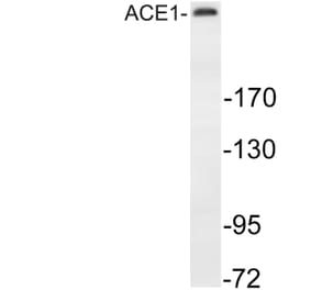 Western Blot - Anti-MAP-2 Antibody (R12-2232) - Antibodies.com