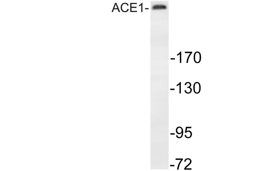 Western Blot - Anti-MAP-2 Antibody (R12-2232) - Antibodies.com