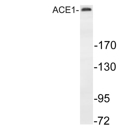 Western Blot - Anti-MAP-2 Antibody (R12-2232) - Antibodies.com