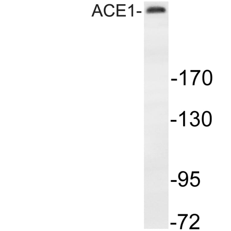 Western Blot - Anti-MAP-2 Antibody (R12-2232) - Antibodies.com