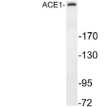 Western Blot - Anti-MAP-2 Antibody (R12-2232) - Antibodies.com