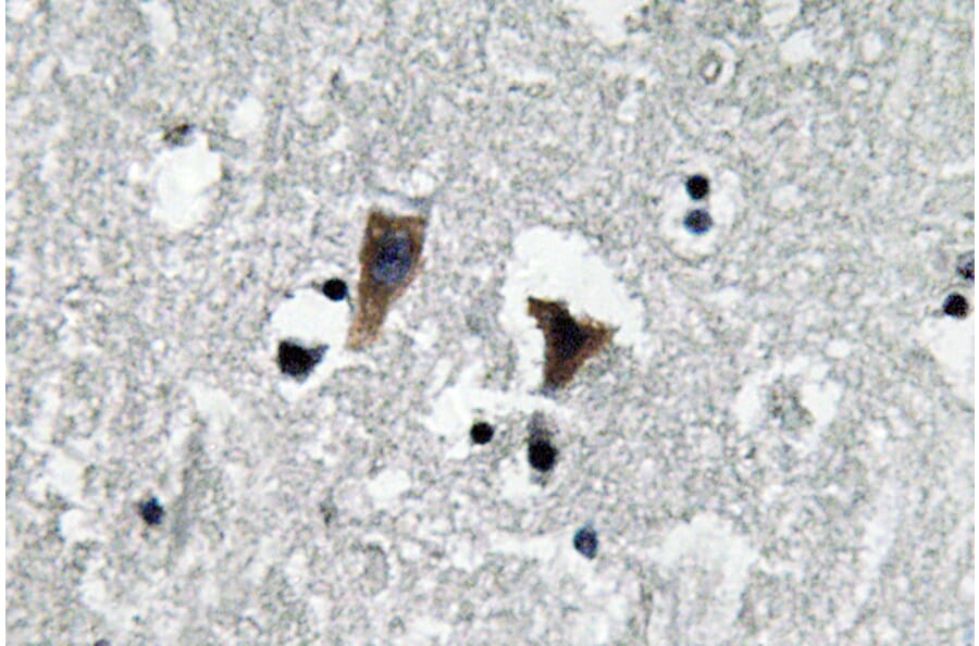 Immunohistochemistry - Anti-MAO-A Antibody (R12-2231) - Antibodies.com