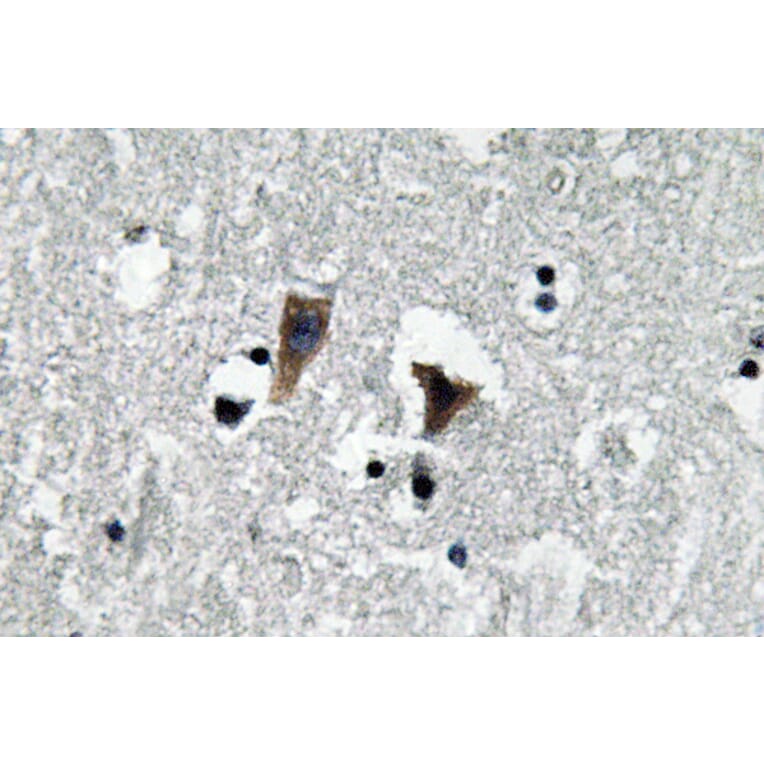 Immunohistochemistry - Anti-MAO-A Antibody (R12-2231) - Antibodies.com