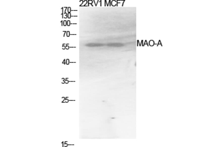 Western Blot - Anti-MAO-A Antibody (R12-2231) - Antibodies.com