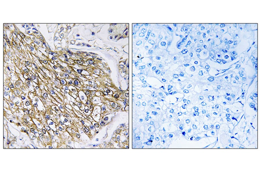 Immunohistochemistry - Anti-LPHN2 Antibody (G378) - Antibodies.com