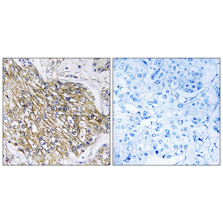 Immunohistochemistry - Anti-LPHN2 Antibody (G378) - Antibodies.com