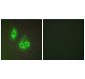 Immunofluorescence - Anti-LAMA3 Antibody (C13066) - Antibodies.com