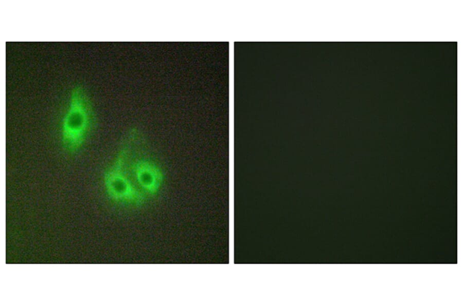 Immunofluorescence - Anti-LAMA3 Antibody (C13066) - Antibodies.com