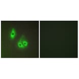 Immunofluorescence - Anti-LAMA3 Antibody (C13066) - Antibodies.com