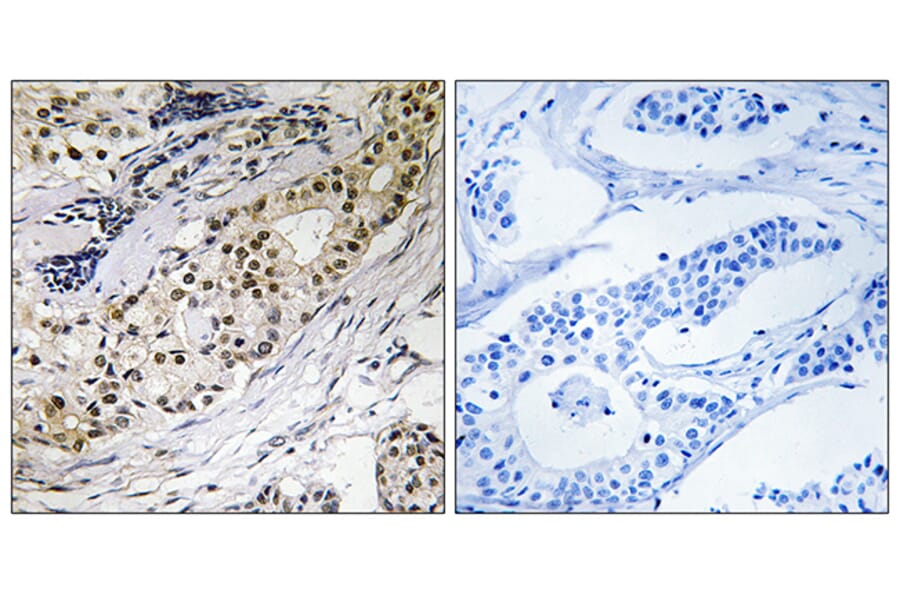 Immunohistochemistry - Anti-LAMA3 Antibody (C13066) - Antibodies.com