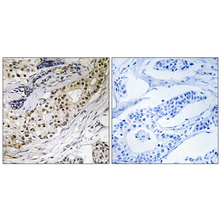 Immunohistochemistry - Anti-LAMA3 Antibody (C13066) - Antibodies.com