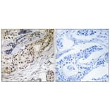Immunohistochemistry - Anti-LAMA3 Antibody (C13066) - Antibodies.com