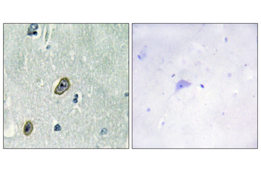 Immunohistochemistry - Anti-KCIP1 Antibody (C11788) - Antibodies.com