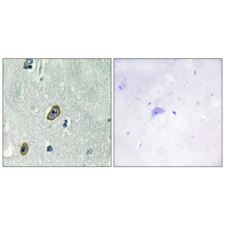 Immunohistochemistry - Anti-KCIP1 Antibody (C11788) - Antibodies.com