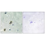 Immunohistochemistry - Anti-KCIP1 Antibody (C11788) - Antibodies.com
