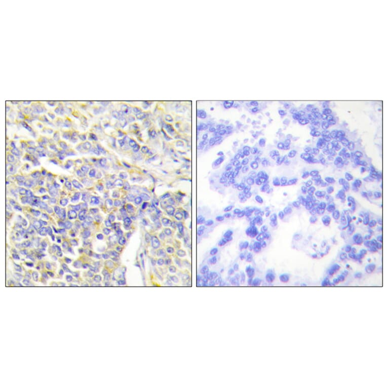 Immunohistochemistry - Anti-KAD1 Antibody (C10259) - Antibodies.com