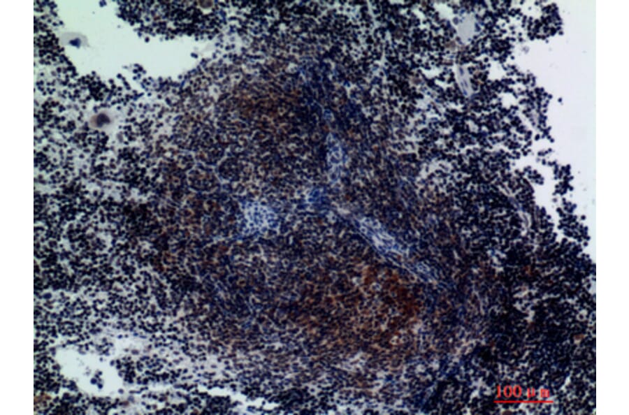 Immunohistochemistry - Anti-ITGA3 Antibody (C30235) - Antibodies.com