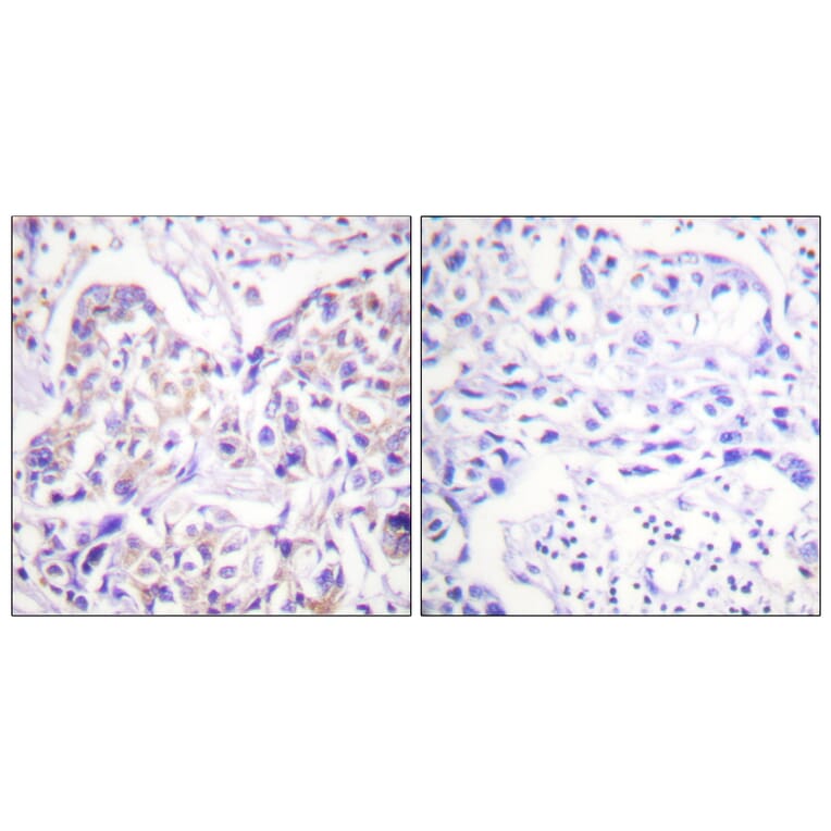 Immunohistochemistry - Anti-IRS-1 Antibody (B0497) - Antibodies.com