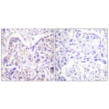 Immunohistochemistry - Anti-IRS-1 Antibody (B0497) - Antibodies.com
