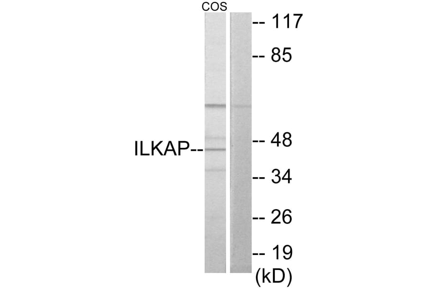 Western Blot - Anti-ILKAP Antibody (C11670) - Antibodies.com