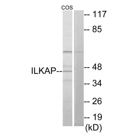 Western Blot - Anti-ILKAP Antibody (C11670) - Antibodies.com