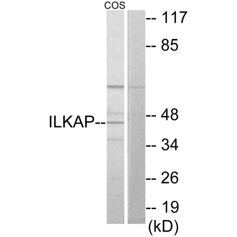 Western Blot - Anti-ILKAP Antibody (C11670) - Antibodies.com