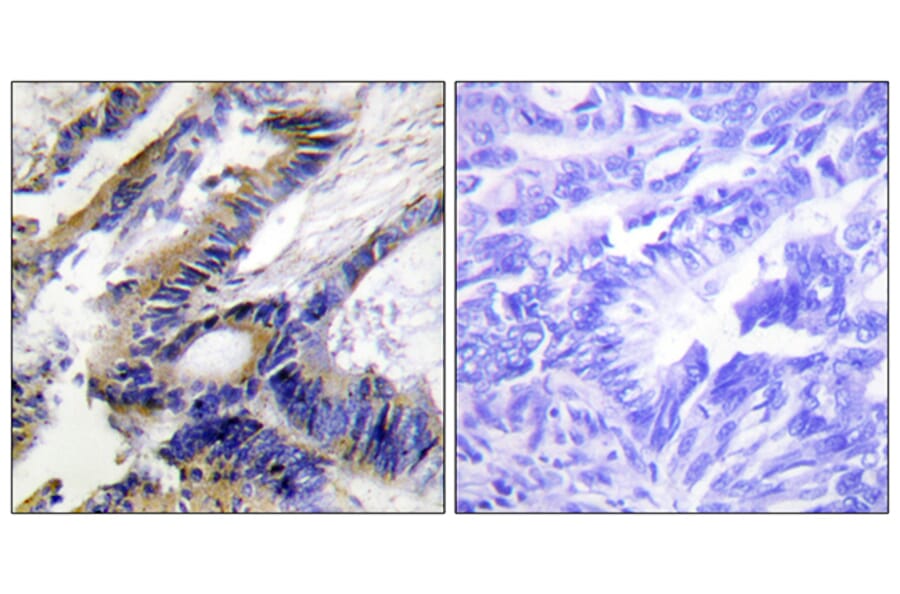 Immunohistochemistry - Anti-ILKAP Antibody (C11670) - Antibodies.com