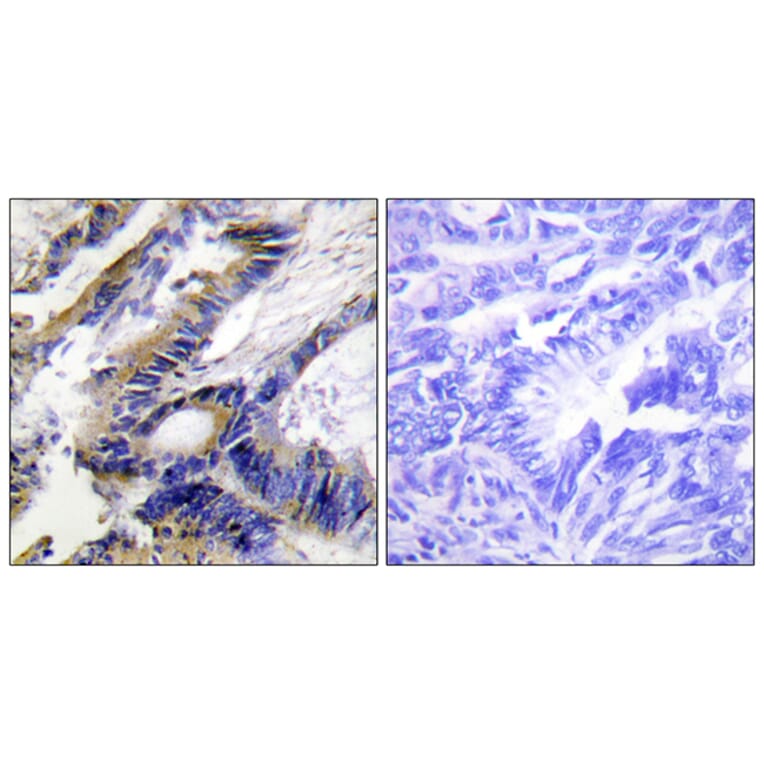 Immunohistochemistry - Anti-ILKAP Antibody (C11670) - Antibodies.com