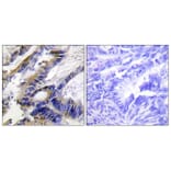 Immunohistochemistry - Anti-ILKAP Antibody (C11670) - Antibodies.com