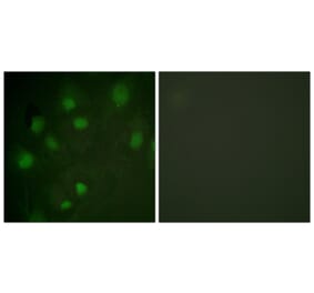 Immunofluorescence - Anti-IGF2R Antibody (B1051) - Antibodies.com