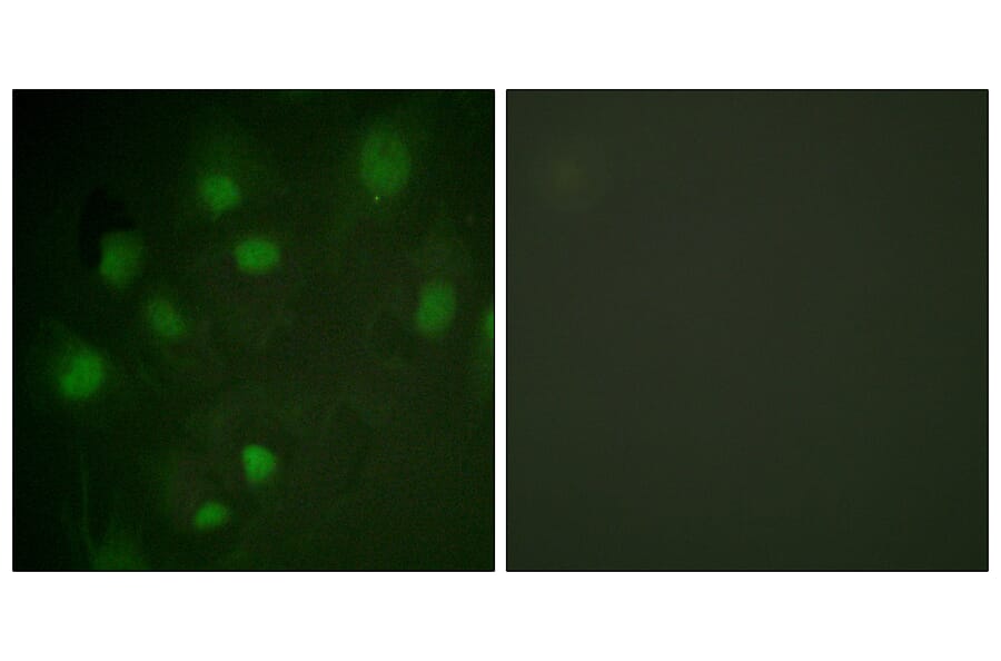 Immunofluorescence - Anti-IGF2R Antibody (B1051) - Antibodies.com
